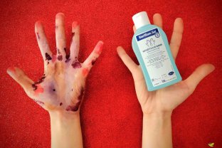 El concurs busca promoure el rentat de mans entre els professionals sanitaris.